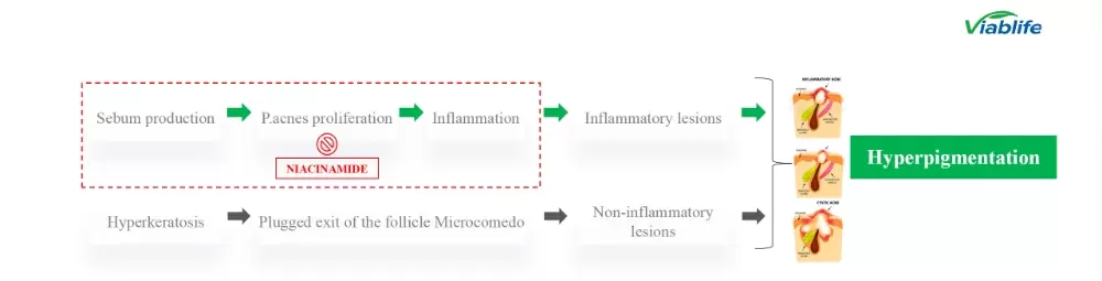 Nicotinamide in Cosmetics: Effective Oil Control and Acne Suppression Nicotinamide in Cosmetics: Effective Oil Control and Acne Suppression