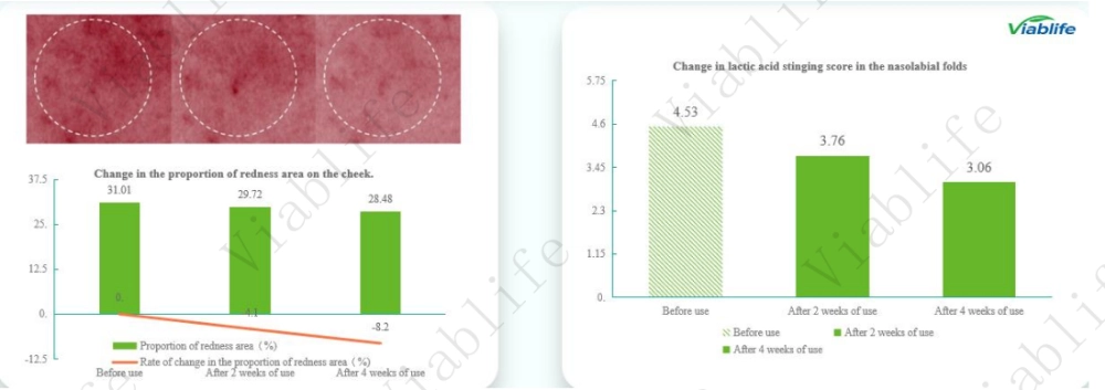 Improvement in Lactic Acid Stinging Response